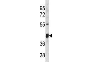 Txnip antibody western blot analysis in mouse stomach tissue lysate. (TXNIP Antikörper  (AA 116-145))