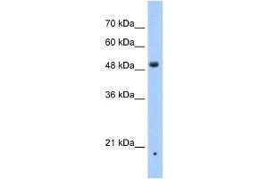 ZDHHC16 antibody used at 1 ug/ml to detect target protein. (ZDHHC16 Antikörper  (N-Term))