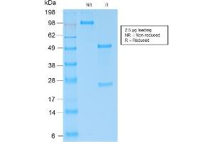 SDS-PAGE Analysis of Purified Kappa Light Chain Rabbit Recombinant Monoclonal (KLC2289R). (Rekombinanter IGKC Antikörper)