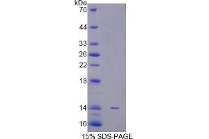 SDS-PAGE analysis of Human STAT5A Protein. (STAT5A Protein)
