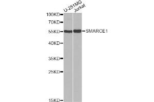 Western blot analysis of extracts of various cell lines, using SMARCE1 antibody. (SMARCE1 Antikörper)