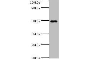 Western blot All lanes: HYAL1 antibody at 2 μg/mL + HepG2 whole cell lysate Secondary Goat polyclonal to rabbit IgG at 1/10000 dilution Predicted band size: 49, 46, 28, 24, 20, 11, 38 kDa Observed band size: 49 kDa (HYAL1 Antikörper  (AA 136-435))