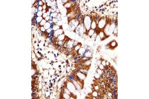 Immunohistochemistry (Paraffin-embedded Sections) (IHC (p)) image for anti-Proteasome (Prosome, Macropain) 26S Subunit, ATPase, 1 (PSMC1) (AA 408-436), (C-Term) antibody (ABIN1881692)