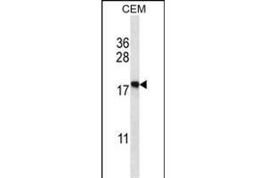 EIF5A2 Antibody (C-term) (ABIN657973 and ABIN2846919) western blot analysis in CEM cell line lysates (35 μg/lane). (EIF5A2 Antikörper  (C-Term))