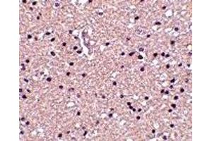 Immunohistochemistry (IHC) image for anti-Stathmin 1 (STMN1) (N-Term) antibody (ABIN1031495) (Stathmin 1 Antikörper  (N-Term))