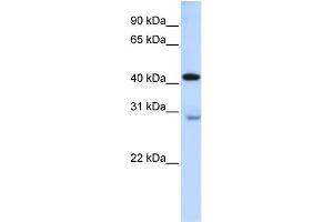 WB Suggested Anti-GRAMD2 Antibody Titration:  0. (GRAMD2 Antikörper  (Middle Region))