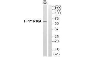Western blot analysis of extracts from Rat heart cells, using PPP1R16A antibody. (PPP1R16A Antikörper)
