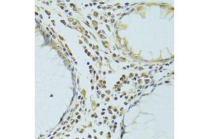 Immunohistochemistry of paraffin-embedded human colon using METTL13 antibody. (METTL13 Antikörper)