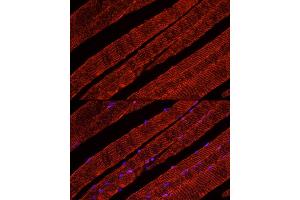 Immunofluorescence (IF) image for anti-Solute Carrier Family 2 (Facilitated Glucose Transporter), Member 4 (SLC2A4) (C-Term) antibody (ABIN6147963)