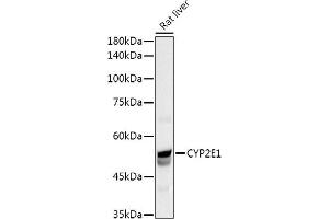 Western blot analysis of extracts of Rat liver, using CYP2E1 Rabbit pAb antibody (ABIN3023078, ABIN3023079, ABIN3023080 and ABIN6219379) at 1:1000 dilution. (CYP2E1 Antikörper  (AA 234-493))