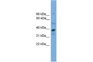 WB Suggested Anti-APEX1 Antibody Titration: 0. (APEX1 Antikörper  (Middle Region))