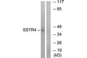 Western blot analysis of extracts from LOVO cells, using SSTR4 Antibody. (SSTR4 Antikörper  (AA 155-204))