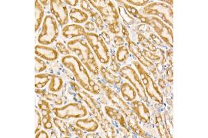 Immunohistochemistry (IHC) image for anti-Prohibitin (PHB) (AA 73-272) antibody (ABIN3020628)