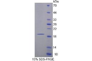 SDS-PAGE analysis of Rat MARCO Protein.