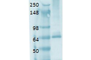 Western Blot analysis of Human thyroid lysate showing detection of Sodium Iodide Symporter protein using Mouse Anti-Sodium Iodide Symporter Monoclonal Antibody, Clone 14F . (SLC5A5 Antikörper  (AA 468-643) (Atto 488))