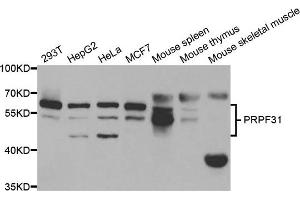 Western blot analysis of extracts of various cell lines, using PRPF31 antibody. (PRPF31 Antikörper)