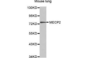 Western Blotting (WB) image for anti-Methyl CpG Binding Protein 2 (MECP2) (AA 1-280) antibody (ABIN5663752) (MECP2 Antikörper  (AA 1-280))