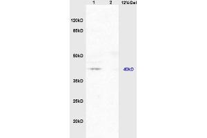 SDS-PAGE (SDS) image for anti-Nuclear Receptor Subfamily 1, Group I, Member 2 (NR1I2) (AA 101-150) antibody (ABIN738816)