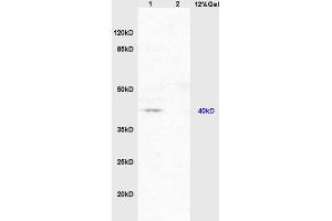 Lane 1: mouse brain lysates Lane 2: mouse embryo lysates probed with Anti PAR-2 Polyclonal Antibody, Unconjugated (ABIN738816) at 1:200 in 4 °C.