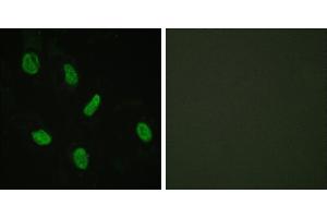 Peptide - +Immunohistochemistry analysis of paraffin-embedded human brain tissue using Androgen Receptor antibody. (Androgen Receptor Antikörper  (Internal Region))