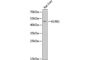 Western blot analysis of extracts of rat liver, using KLRB1 antibody (ABIN6130055, ABIN6142970, ABIN6142972 and ABIN6222669) at 1:3000 dilution. (CD161 Antikörper  (AA 73-140))