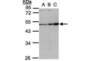 WB Image Sample(30 ug whole cell lysate) A:H1299 B:HeLa S3, C:Hep G2 , 10% SDS PAGE antibody diluted at 1:1000 (INHBA Antikörper  (C-Term))
