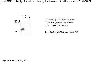 Image no. 2 for anti-Vesicle-Associated Membrane Protein 3 (VAMP3) (N-Term) antibody (ABIN347002) (VAMP3 Antikörper  (N-Term))