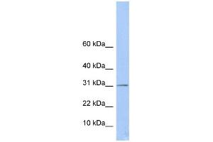 WB Suggested Anti-ECHDC1 Antibody Titration:  0. (ECHDC1 Antikörper  (Middle Region))