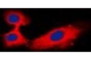 Immunofluorescent analysis of Rabphilin 3A staining in Hela cells. (RPH3A Antikörper)