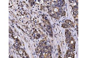 IHC analysis of EXOSC3 using anti-EXOSC3 antibody (ABIN7602216). (EXOSC3 Antikörper  (AA 64-275))