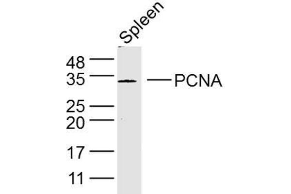 PCNA Antikörper  (AA 151-261)