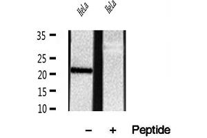 Western blot analysis of extracts of HeLa cells, using REEP5 antibody. (REEP5 Antikörper  (N-Term))