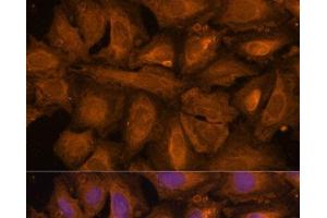 Immunofluorescence analysis of U-2 OS cells using STUB1 Polyclonal Antibody at dilution of 1:100 (40x lens). (STUB1 Antikörper)