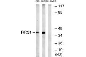Western blot analysis of extracts from HuvEc/293 cells, using RRS1 Antibody. (RRS1 Antikörper  (AA 254-303))