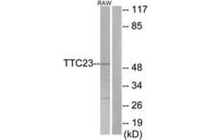 Western blot analysis of extracts from RAW264. (TTC23 Antikörper  (AA 341-390))