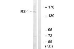 Western Blotting (WB) image for anti-Insulin Receptor Substrate 1 (IRS1) (AA 279-328) antibody (ABIN2889010) (IRS1 Antikörper  (AA 279-328))