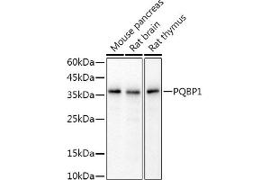 Western blot analysis of extracts of various cell lines, using PQBP1 antibody (ABIN7269452) at 1:1000 dilution. (PQBP1 Antikörper)
