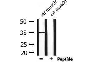 Western blot analysis of extracts from rat muscle, using TAS2R44 Antibody. (TAS2R31 Antikörper)