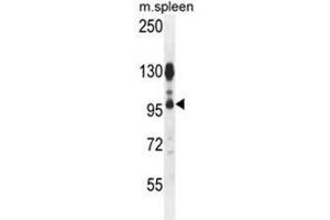 ACAP1 Antibody (N-term) western blot analysis in mouse spleen tissue lysates (35 µg/lane). (ACAP1 Antikörper  (N-Term))