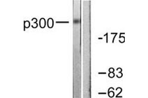 Western blot analysis of extracts from MDA-MB-435 cells, using p300 Antibody. (p300 Antikörper  (AA 1-50))