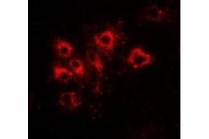 Immunofluorescent analysis of Tapasin staining in Hela cells. (TAPBP Antikörper)