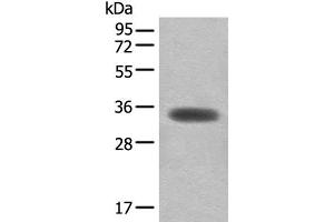 Western blot analysis of Mouse skeletal muscle tissue lysate using MYOZ2 Polyclonal Antibody at dilution of 1:450 (MYOZ2 Antikörper)