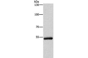 Western Blot analysis of Human colon cancer tissue using CYP2B6 Polyclonal Antibody at dilution of 1:400 (CYP2B6 Antikörper)