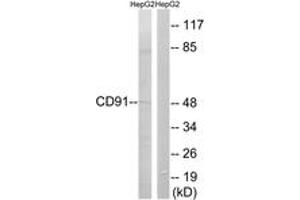 Western blot analysis of extracts from HepG2 cells, using CD91 (Ab-4520) Antibody. (LRP1 Antikörper  (AA 4486-4535))