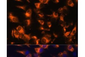 Immunofluorescence analysis of C6 cells using SSTR2 Polyclonal Antibody at dilution of 1:100 (40x lens). (SSTR2 Antikörper)