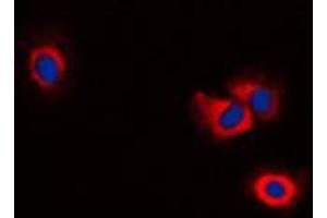Immunofluorescent analysis of ERAP1 staining in NIH3T3 cells. (ERAP1 Antikörper  (Center))
