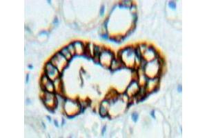 Used in DAB staining on fromalin fixed paraffin-embedded Kidney tissue (FKBP8 Antikörper  (AA 93-339))