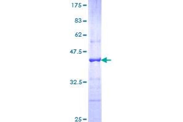 CDH18 Protein (AA 467-576) (GST tag)