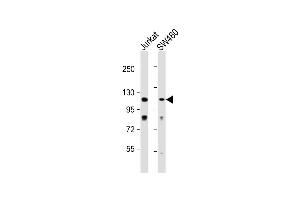 All lanes : Anti-MLK1 Antibody (C-term) at 1:1000 dilution Lane 1: Jurkat whole cell lysate Lane 2: S whole cell lysate Lysates/proteins at 20 μg per lane. (MAP3K9 Antikörper  (C-Term))