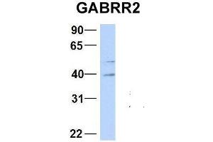 Western Blotting (WB) image for anti-gamma-aminobutyric Acid (GABA) Receptor, rho 2 (GABRR2) (Middle Region) antibody (ABIN2776135)
